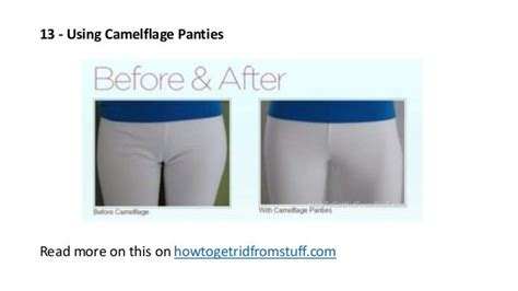 How To Get Rid Of A Camel Toe: Prevention, Remedies, And